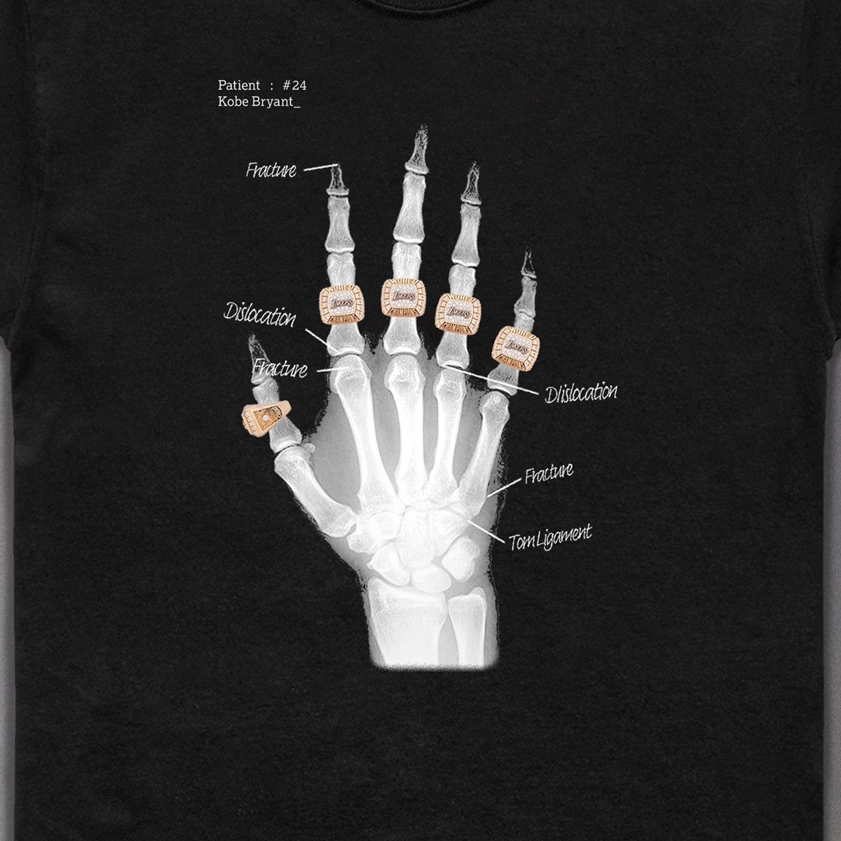 Kobe Mentality × Rare × Streetwear Kobe Bryant Hand X-Ray with 5 NBA ...