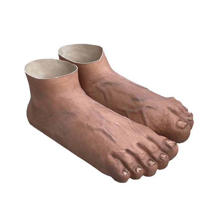 Imran Potato Steps Out In Brand New Foot Shoe 