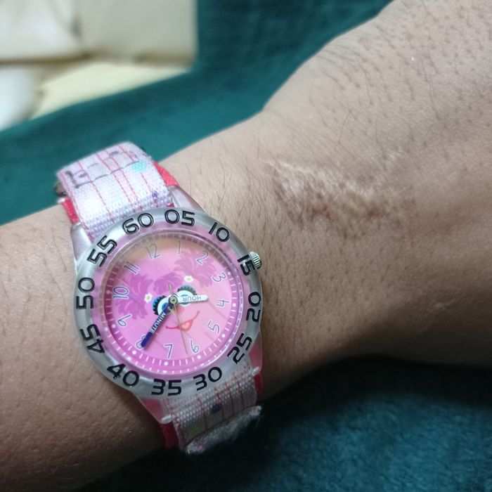 Ladies watch with hot sale velcro strap