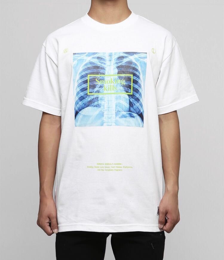 FR2 💚 FR2 X-Ray Smoking Kills White Tee Medium NEW Size US M / EU 48-50 / 2 - 2 Thumbnail