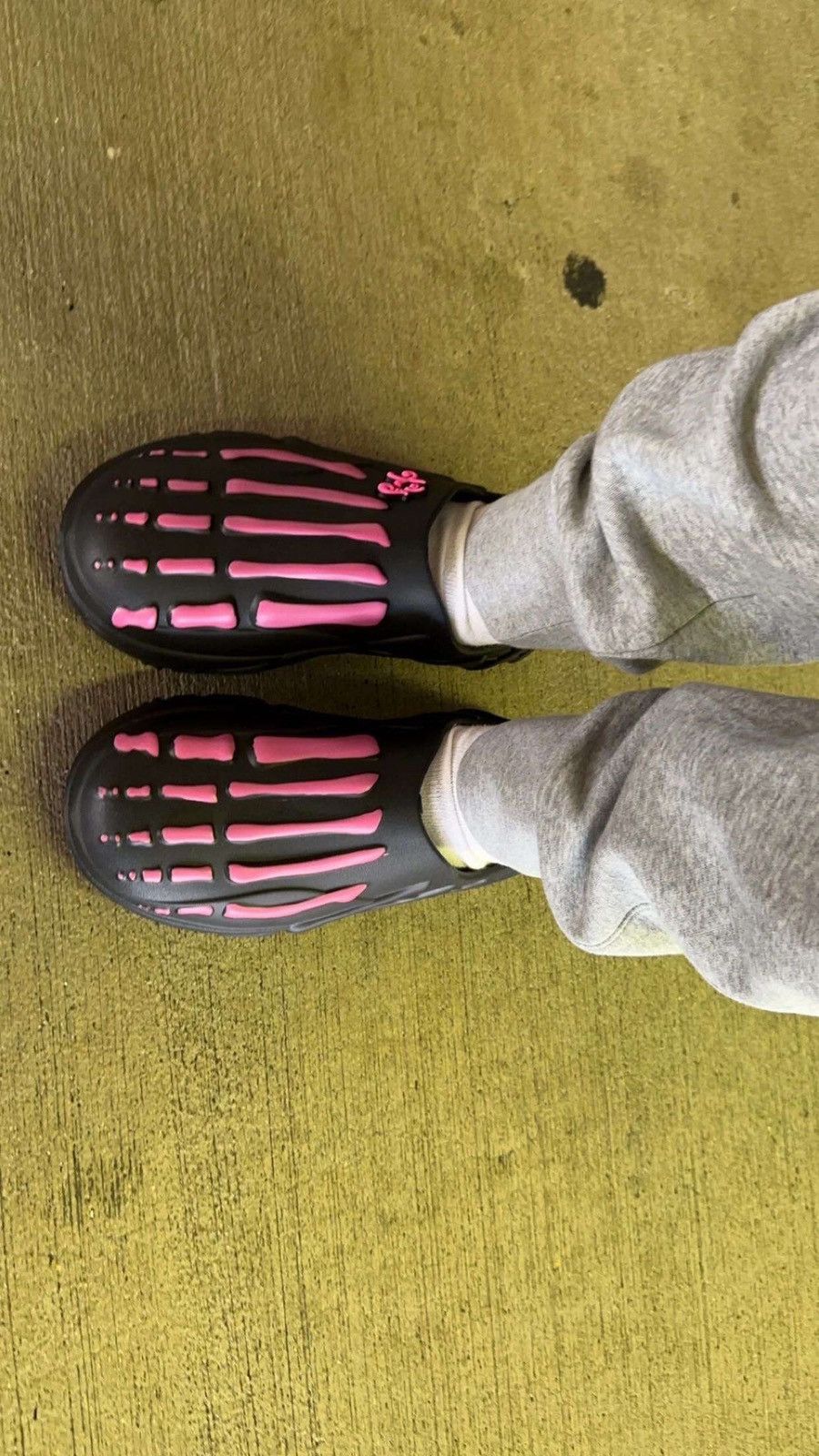 Gnarcotic Skelly runners Size US 11 / EU 44 - 1 Thumbnail