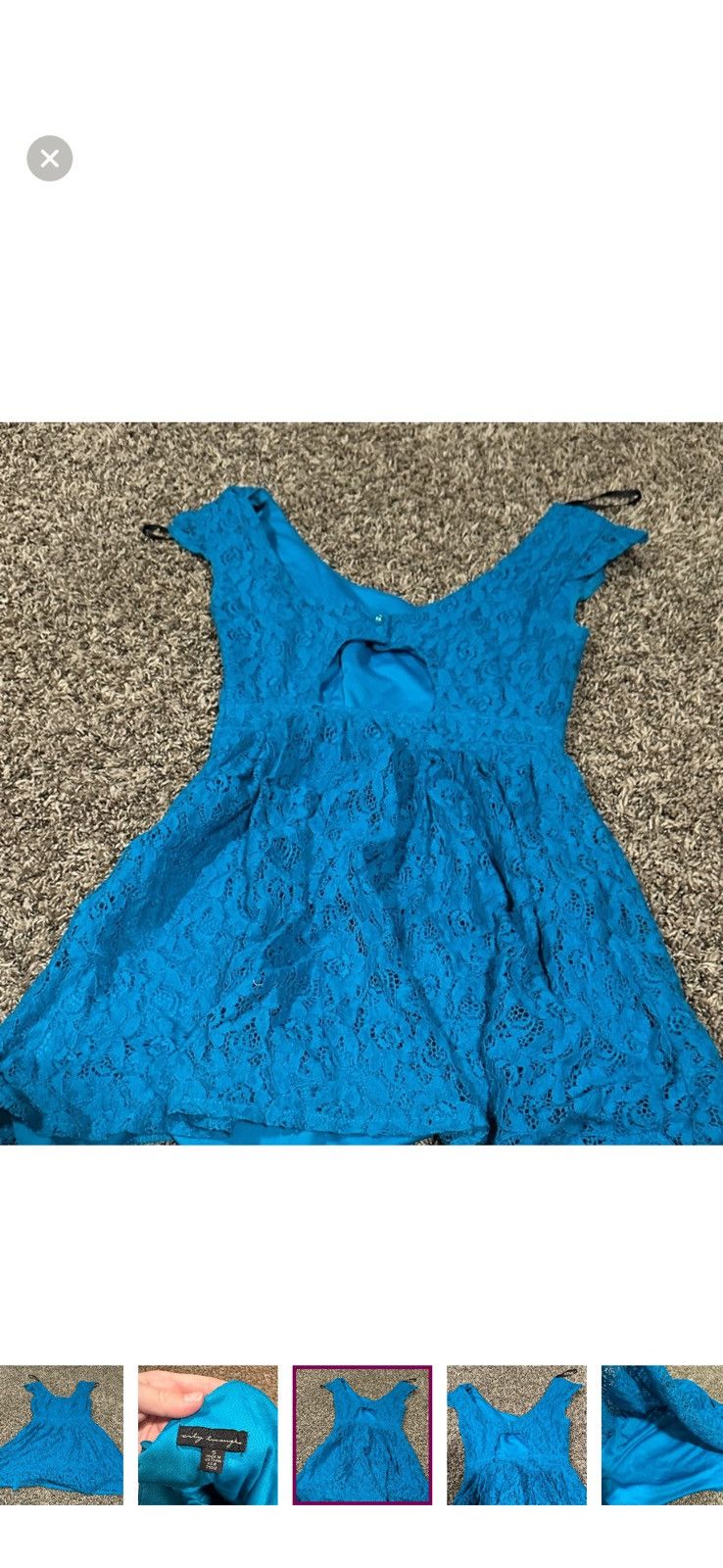 Other Blue cute lace dress Size M / US 6-8 / IT 42-44 - 3 Thumbnail