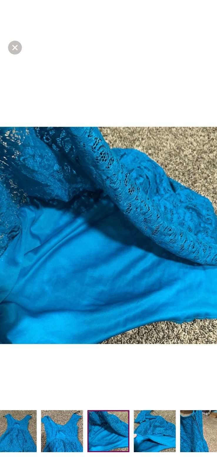 Other Blue cute lace dress Size M / US 6-8 / IT 42-44 - 5 Thumbnail