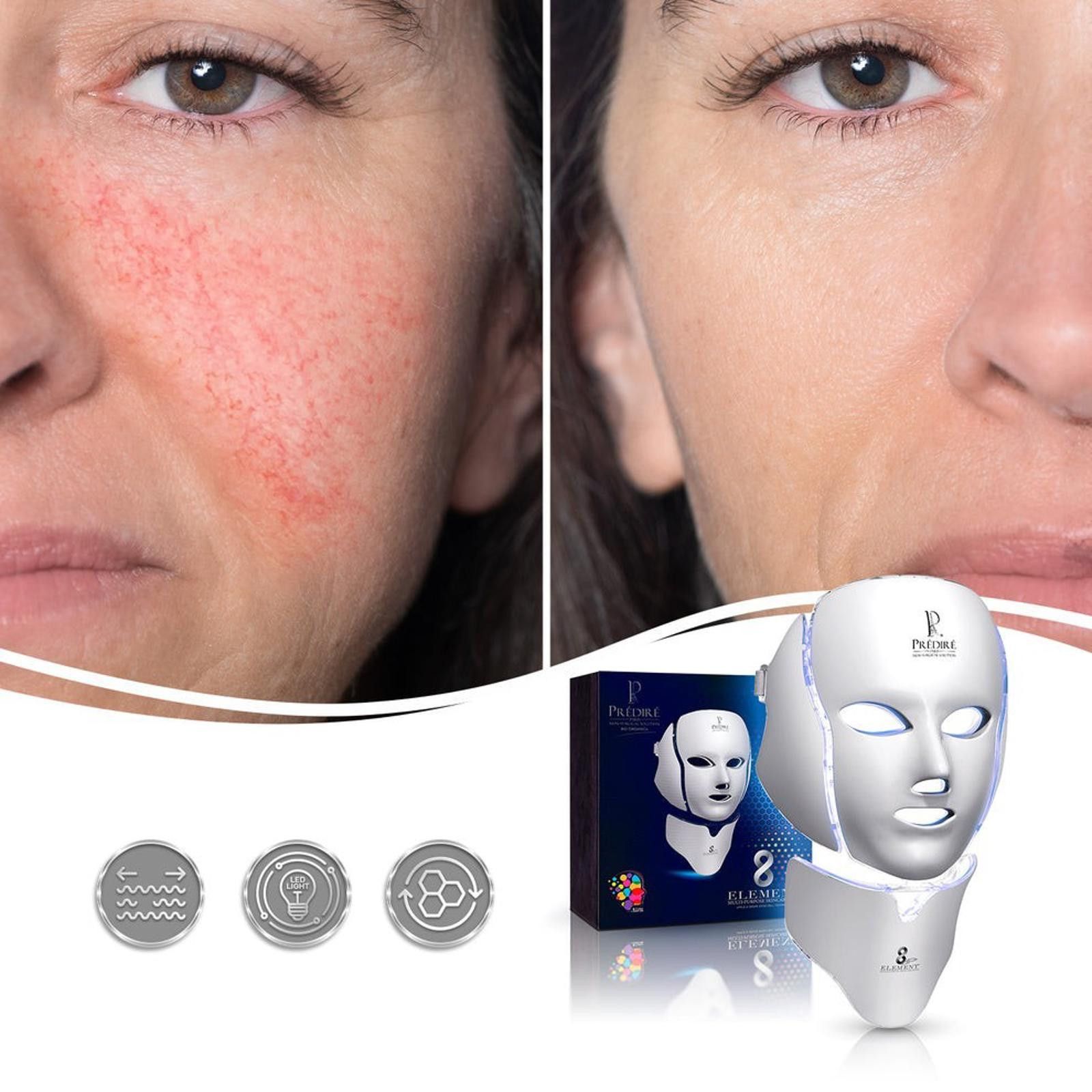 Other Predire Paris Luxury Limited Edition 8LED Multi-Purpose Mask Size ONE SIZE - 4 Thumbnail