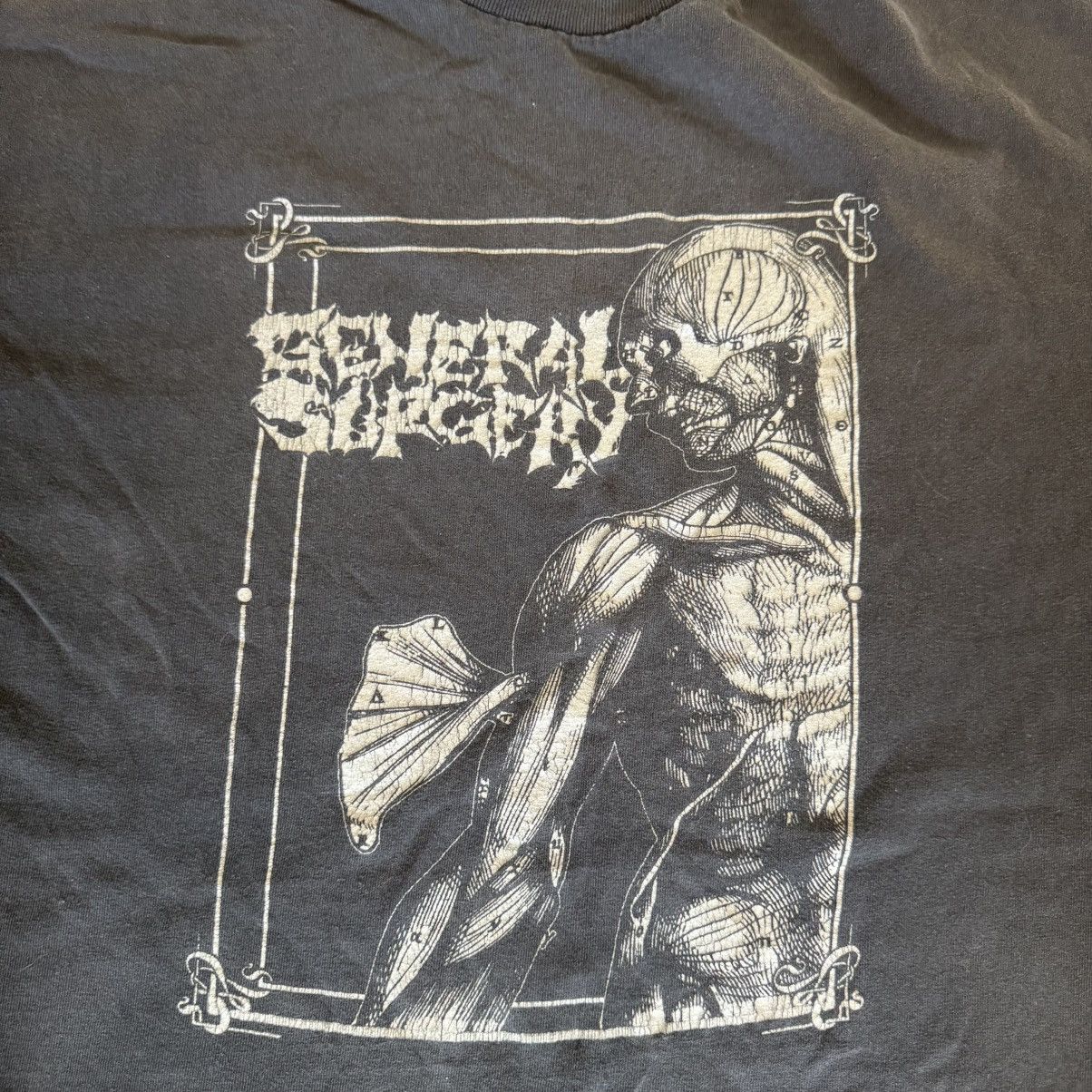 Alstyle general surgery t shirt - faded black/grey Size US XL / EU 56 / 4 - 2 Thumbnail