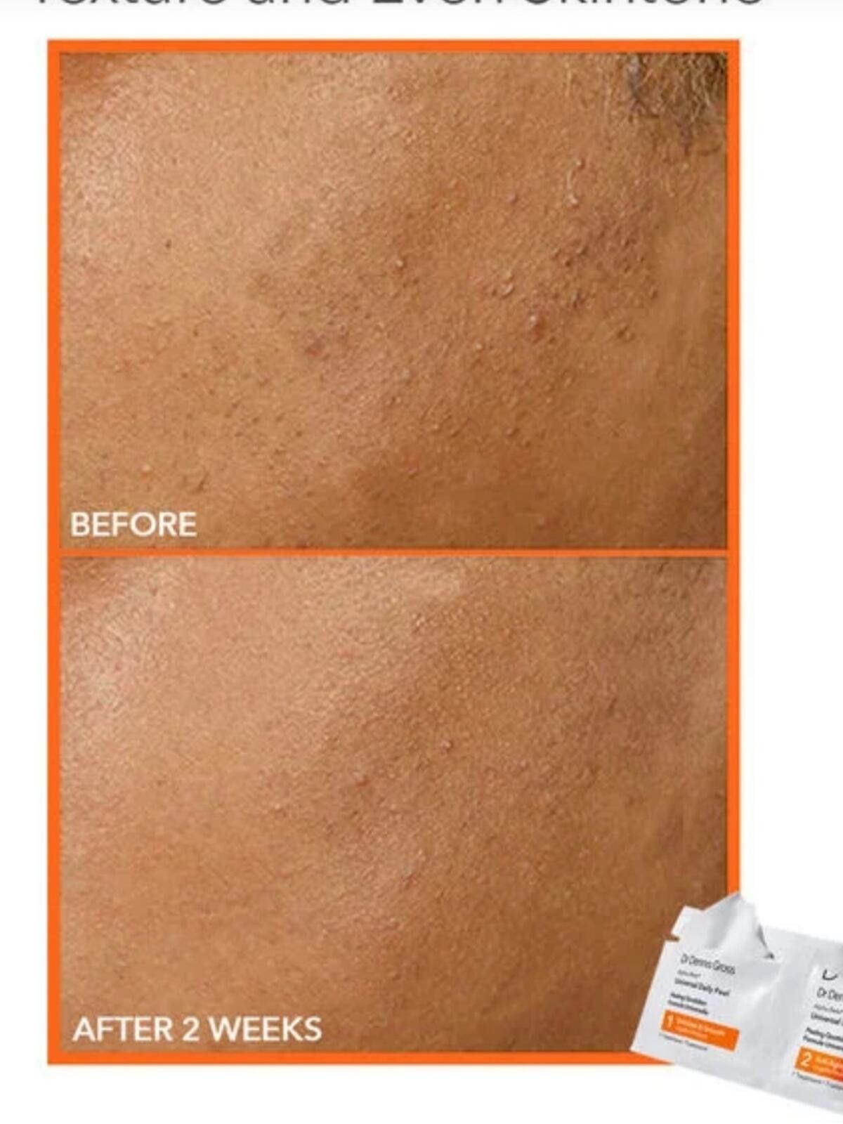 Other Dr Dennis Gross / Alpha Beta Universal Daily Peel 5pk Size ONE SIZE - 3 Thumbnail