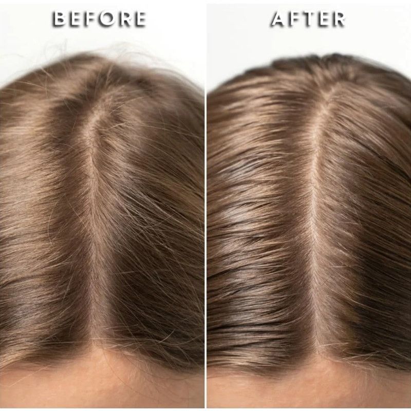 NBDN Nobrandedon MUDMASKY® Vitamin-Infused Scalp Serum 60ml Full Size Size ONE SIZE - 2 Thumbnail