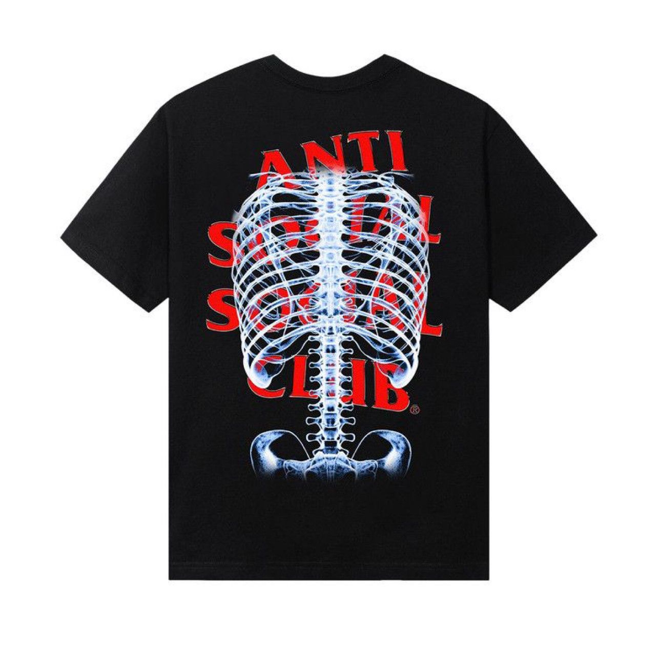 【即発】ANTI SOCIAL SOCIAL CLUB◆ASSC Tonkotsu ロゴ Tシャツ Anti social social club tonkotsu