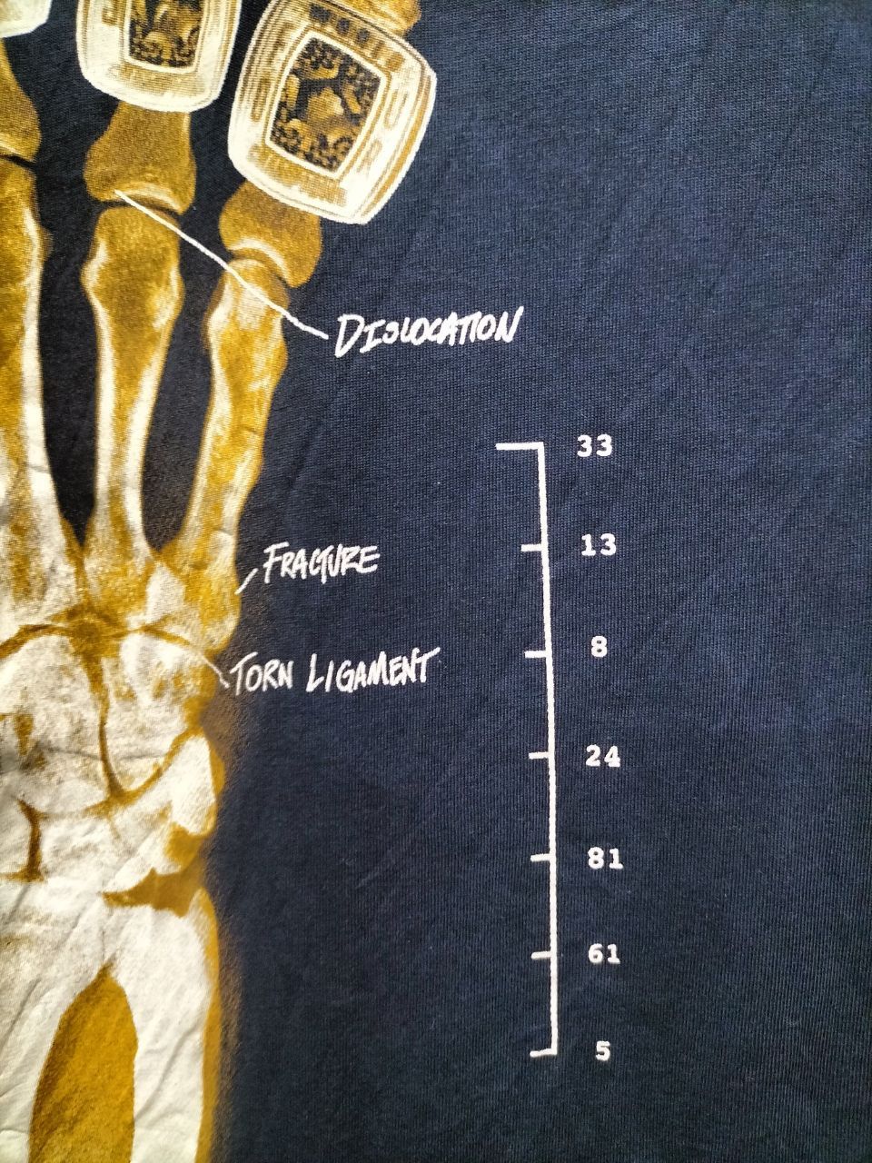 Nike Very Rare Nike Kobe Bryant X-Ray avant garde hba lakers Size US XL / EU 56 / 4 - 6 Thumbnail
