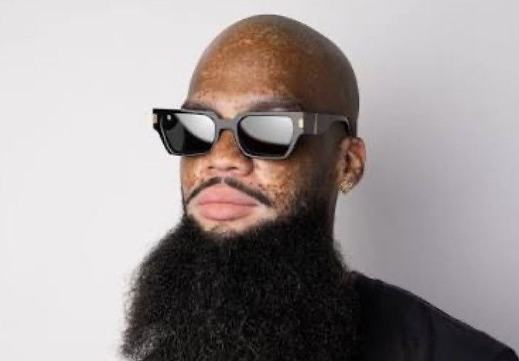 9FIVE 9Five Tiffany Locks Black & 24K Gold Sunglasses – Rare Size ONE SIZE - 4 Thumbnail