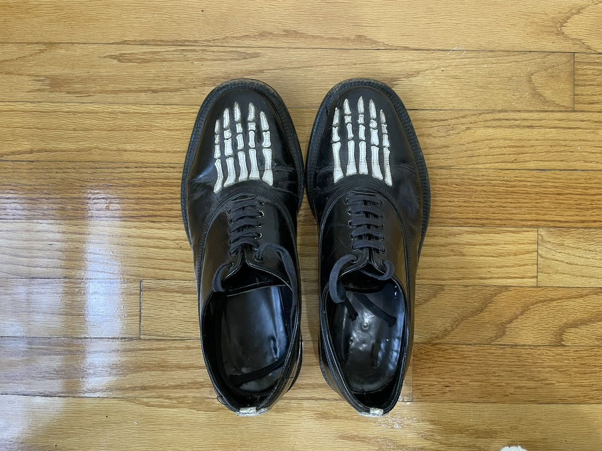 年代が出てこなかったですが00s undercoverism skull dress shoes