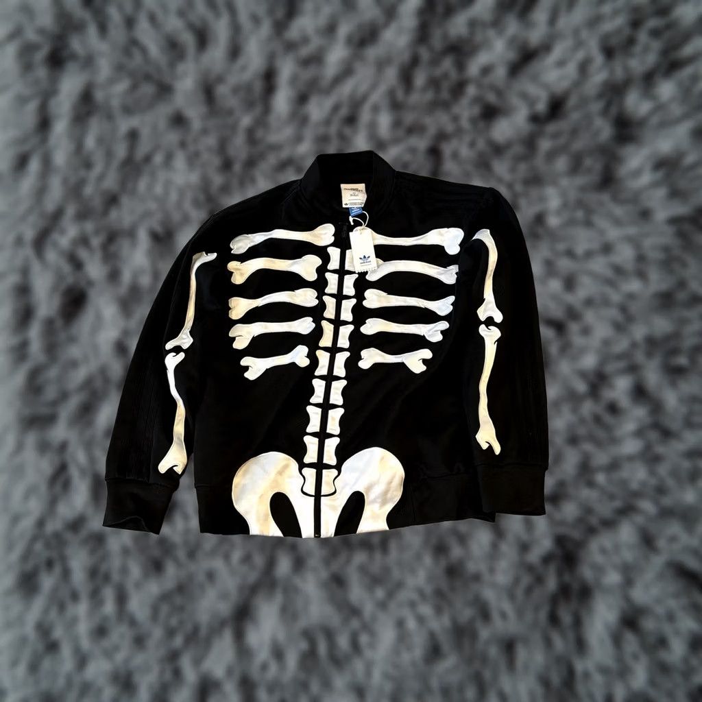 Adidas × Jeremy Scott Jeremy Scott x Adidas X-RAY skeleton jacket