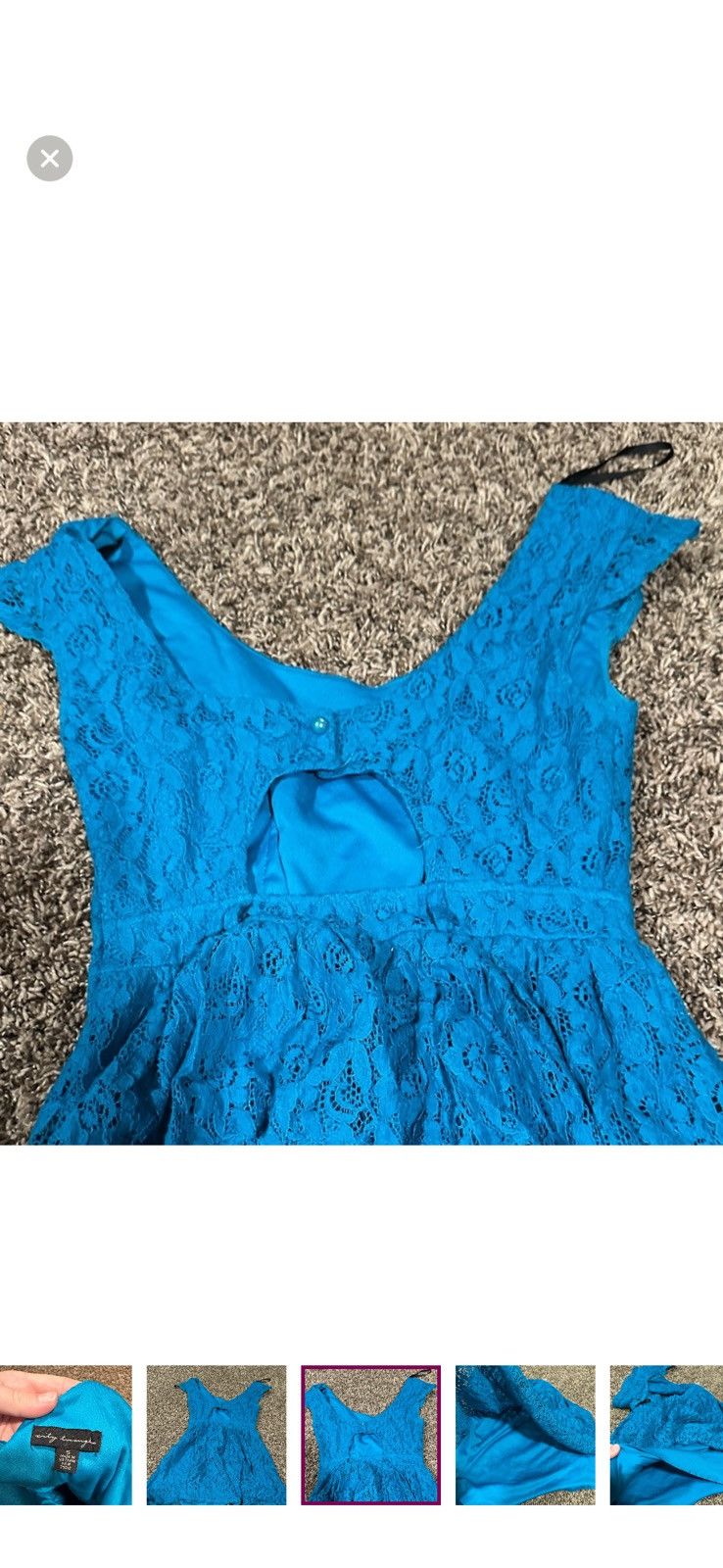 Other Blue cute lace dress Size M / US 6-8 / IT 42-44 - 4 Thumbnail