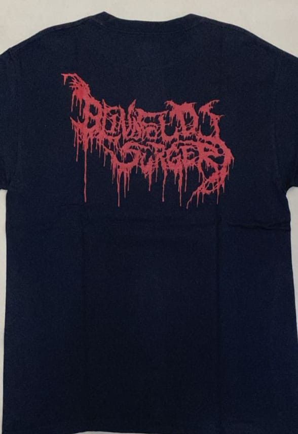 Band Tees Abominable Putridity Blindfold Surgery brutal death metal Size US M / EU 48-50 / 2 - 2 Thumbnail
