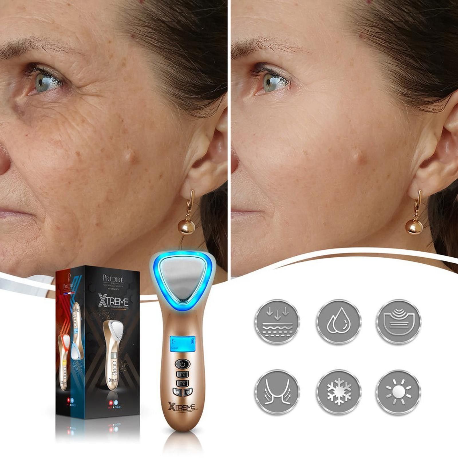 Other Predire Paris Xtreme Skin Rejuvenated Device Hot Cold Size ONE SIZE - 8 Thumbnail