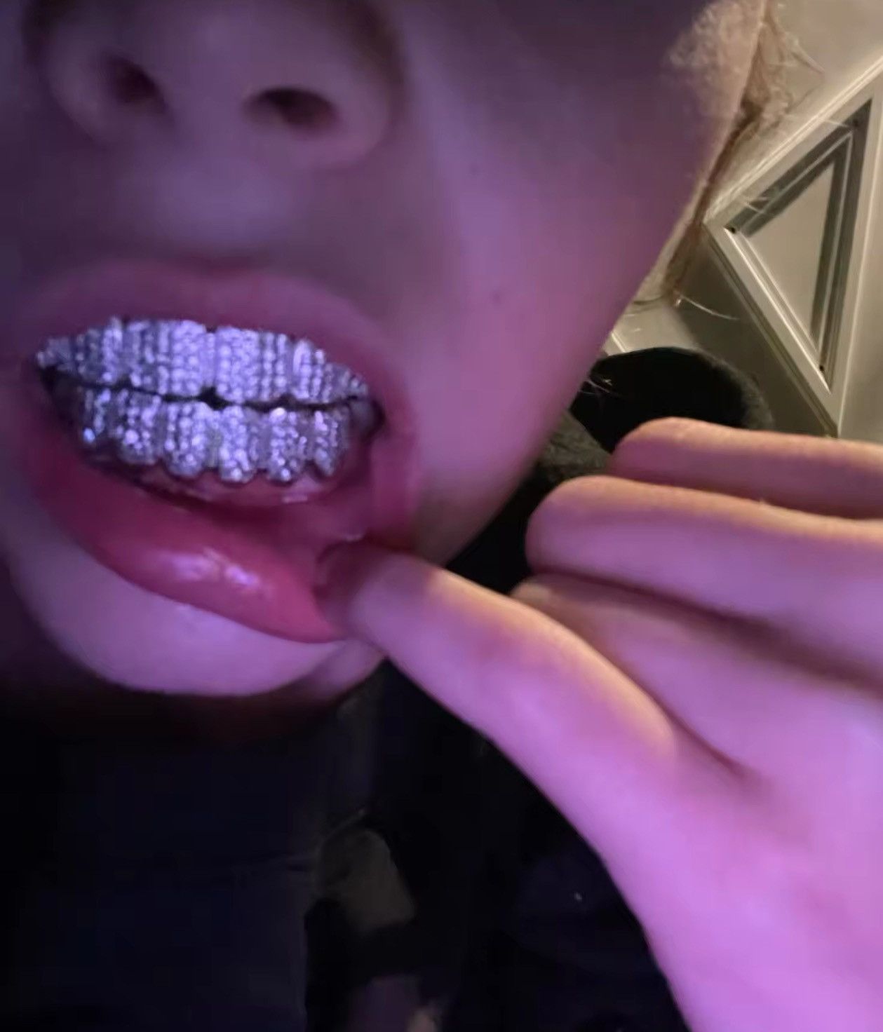 Other Hip hop Teeth Luxury Style Size ONE SIZE - 1 Thumbnail