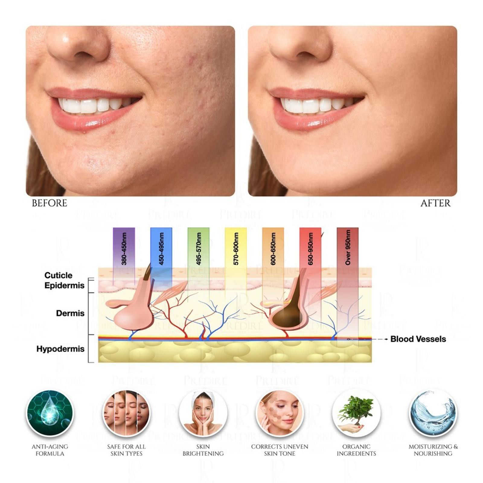 Other Predire 8 Element Multi-Purpose LED Face and Neck Masks Size ONE SIZE - 6 Thumbnail