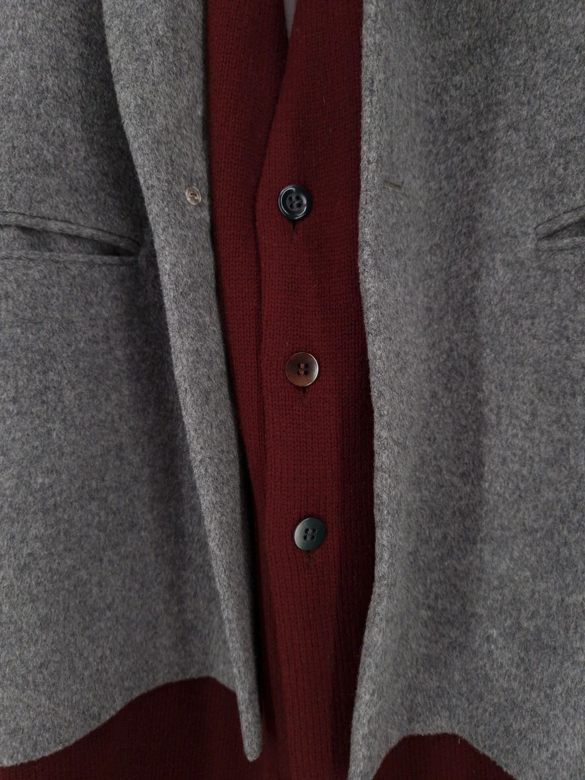 Undercover Undercover Deconstructed Hybrid Coat Size M / US 6-8 / IT 42-44 - 8 Thumbnail