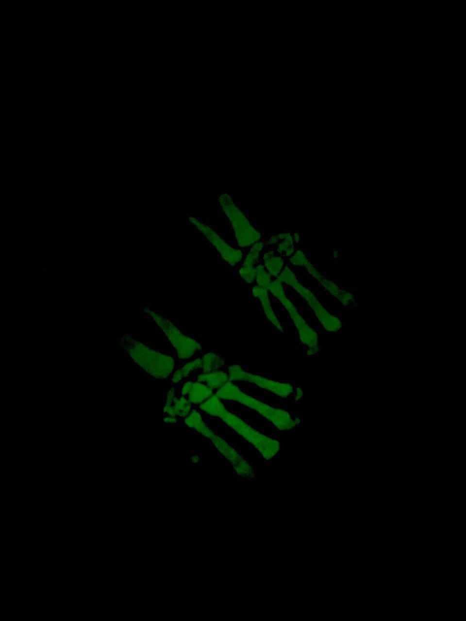 PPFM RARE! Triple Zip Skeleton Glow In Dark Punk Sedation Jacket Size US M / EU 48-50 / 2 - 8 Thumbnail