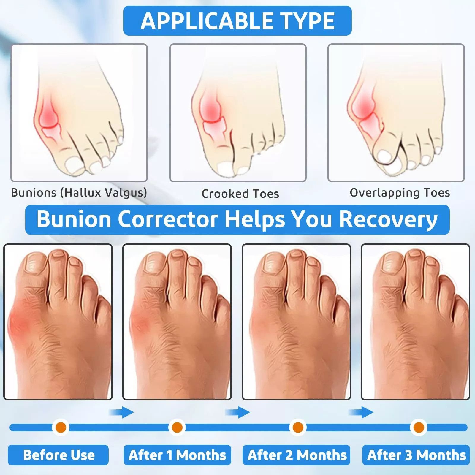 Other Healrecux Bunion Corretor for Men/Women - Factory Sealed Size ONE SIZE - 6 Thumbnail