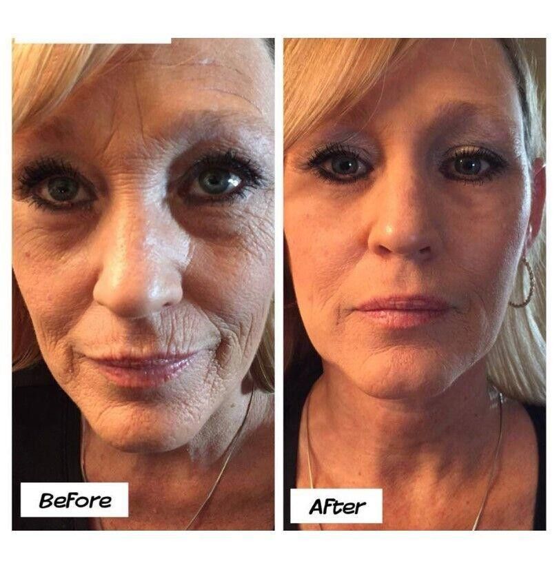 Designer ✨ Ageless Renewal – The Secret to Radiant, Youthful Skin ✨ Size ONE SIZE - 6 Thumbnail