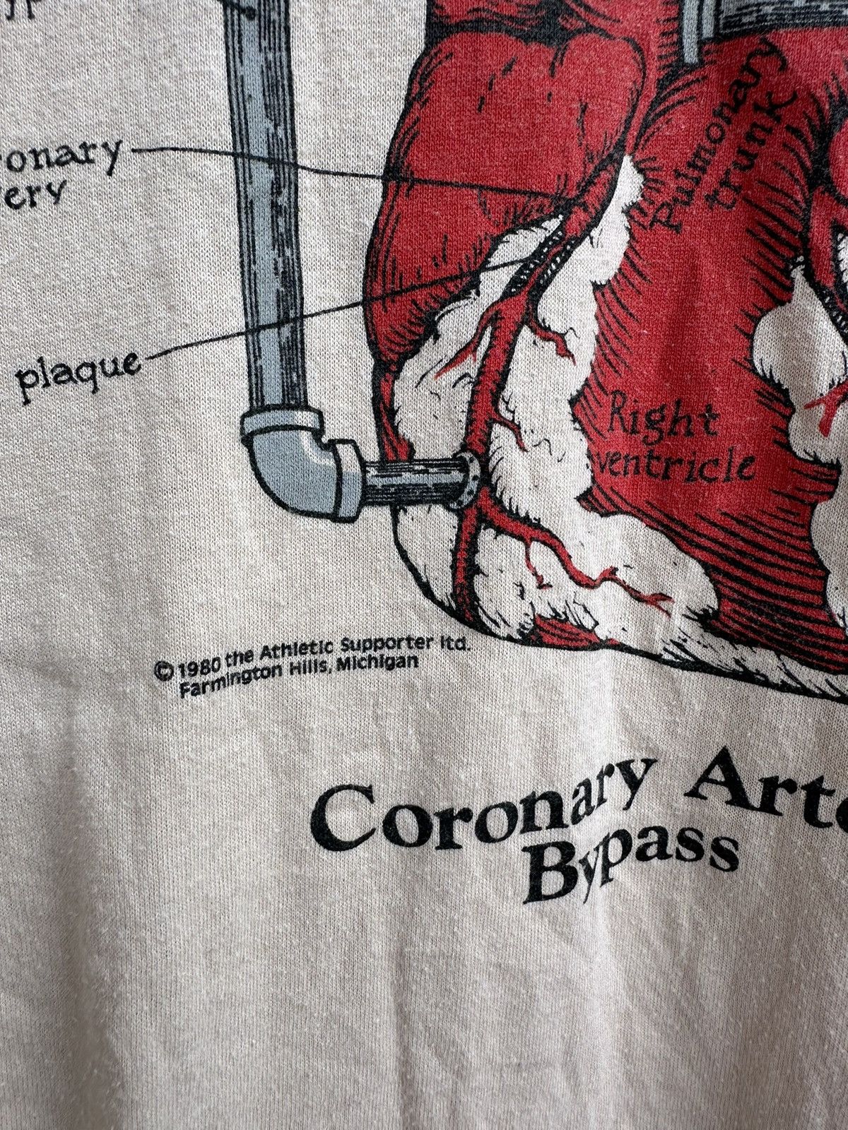 Jerzees Vintage 1980 Coronary Artery Bypass Anatomy Diagram Shirt Size US L / EU 52-54 / 3 - 3 Thumbnail
